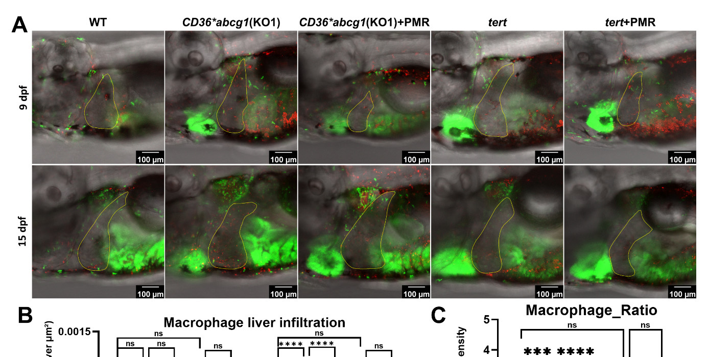 Figure 7A — Zebrafish liver macrophage imaging